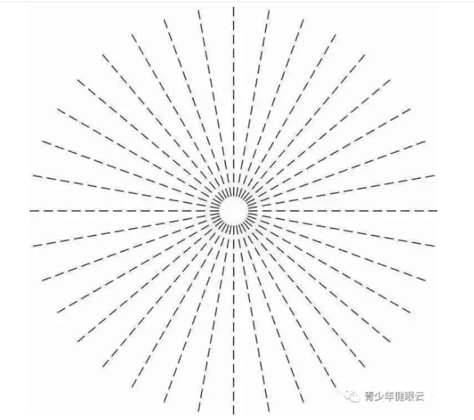 九成的人有散光,究竟什么是散光?