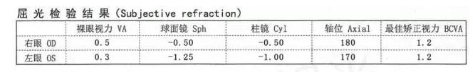 屈光检验结果