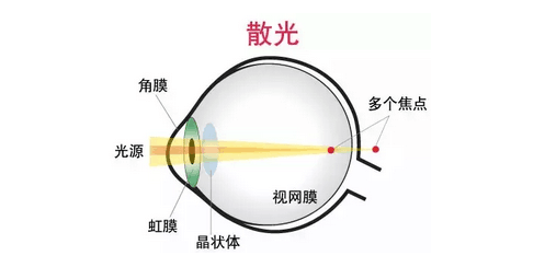 散光原理