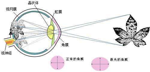 散光视角